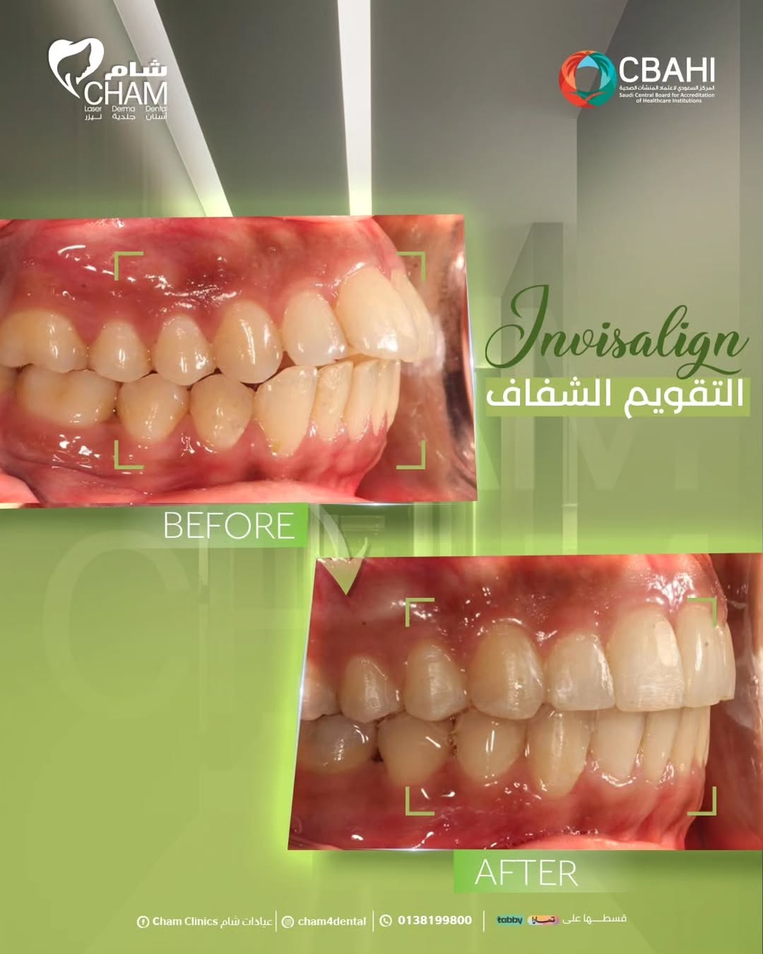 طب وتجميل الأسنان